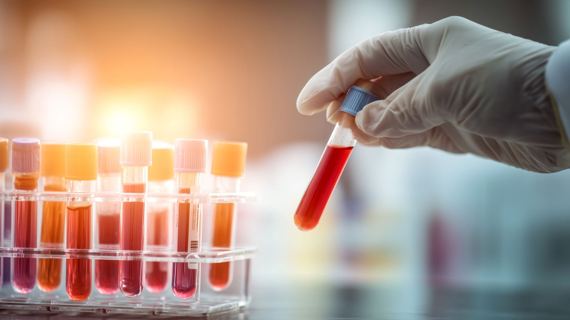 Gloved hand holding a test tube filled with blood, with a rack of multiple test tubes with blood in the background under bright laboratory lighting
